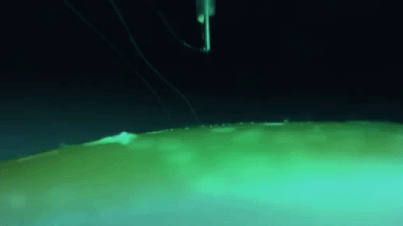 Conductive thread woven into the brain using a machine that resembles a cross between a microscope and a sewing machine